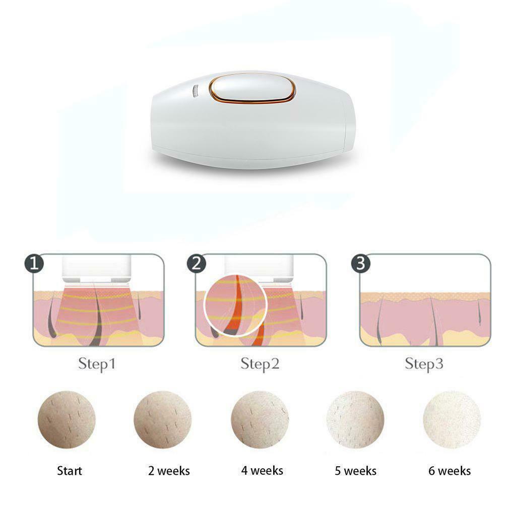IPL Laser Hair Remover Handheld Home Hair Removal System - Dealjas